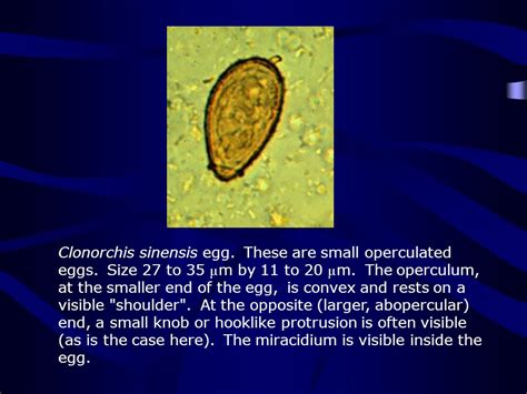 Clonorchis Sinensis: A Tiny Trematode That Thrives Inside You!